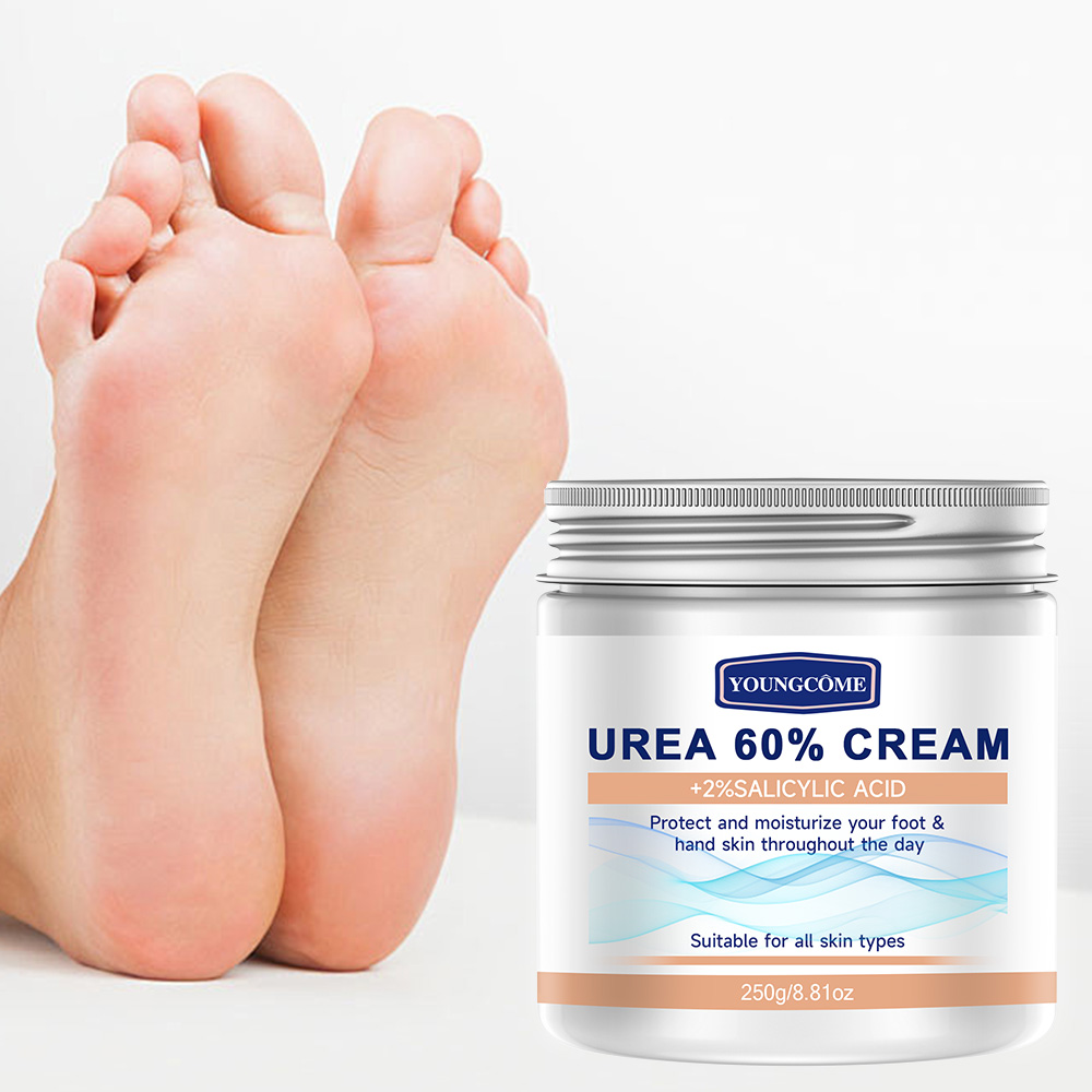 YOUNGCOME 250G Krim Urea denga - Urea Foot Cream ulasan dan harga