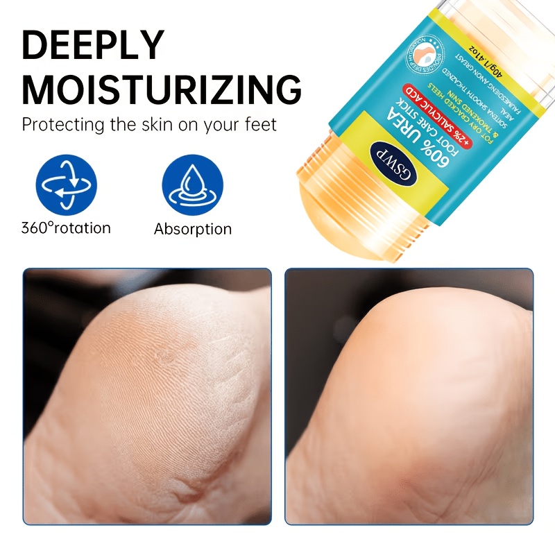 GSWP 60% Urea Foot Care Stick, - Urea Foot Cream ulasan dan harga