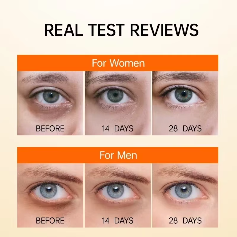Serum Mata Anti Lingkaran Hita - Caffeine Eye Serum ulasan dan harga