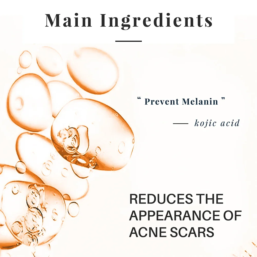 Sabun Asam Kojic Buatan Tangan - Kojic Acid Soap ulasan dan harga